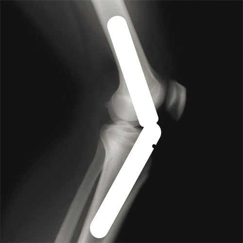 LP Support Knee Stabilizer (Coolprene) 510CP